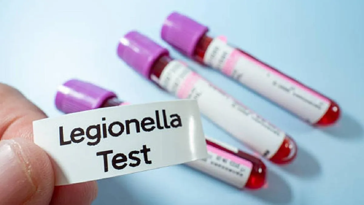 Los síntomas son similares a los de una neumonía: tos persistente, fiebre alta, dolor muscular. / Pixabay