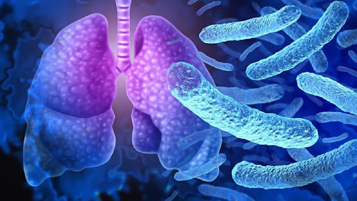 Si bien puede tratarse con antibióticos, se considera peligrosa en adultos mayores y personas con defensas bajas./ Pixabay