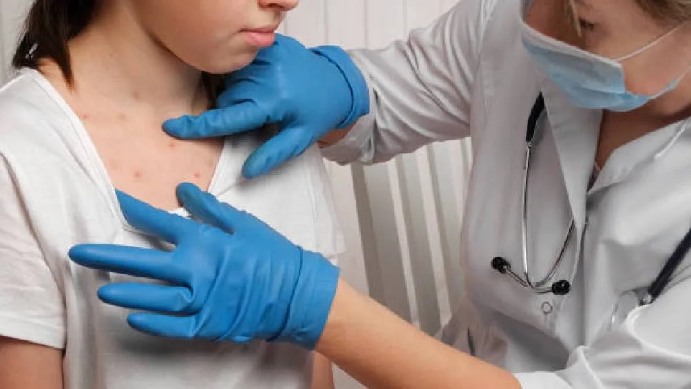 la OMS subraya que el país debe mantener una vigilancia epidemiológica activa. / Pixabay