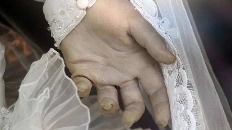 Hay quienes afirman haber visto cambios en la posición de las manos. / X