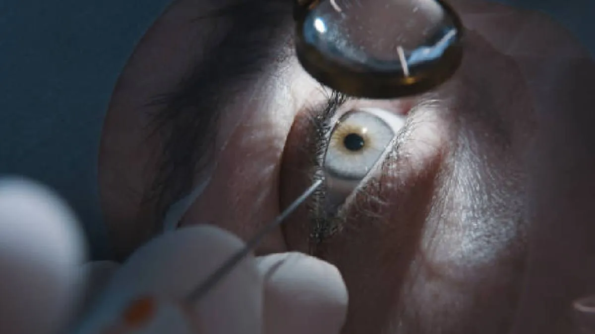 Lentes de contacto, anteojos, aparatos auditivos y prótesis oculares, salvo en casos justificados por discapacidad permanente. / Pixabay