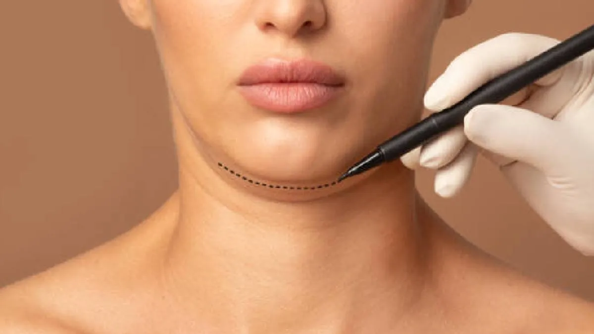 Entre los servicios y tratamientos excluidos se encuentran: Cirugías plásticas o estéticas. / Pixabay