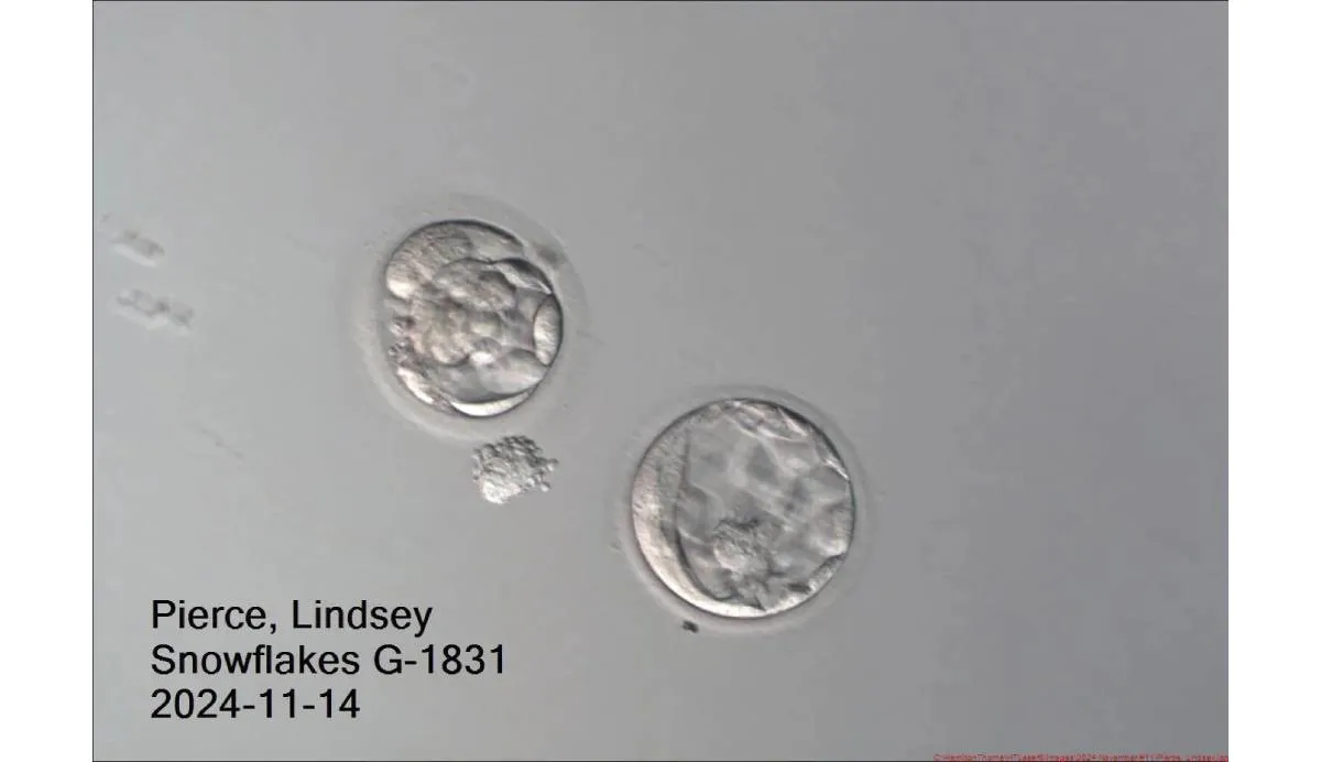 Los dos embriones el 14 de noviembre de 2024, que sobrevivieron a la congelación durante treinta años | AP