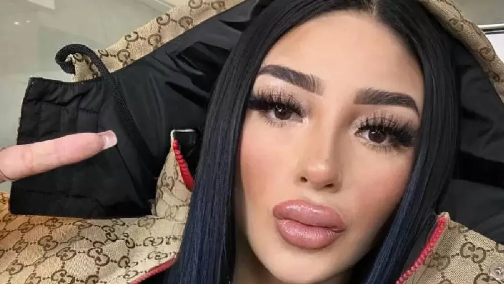 Aunque no dio detalles sobre la clínica ni el cirujano que realizó el procedimiento, Bellakath. / RS