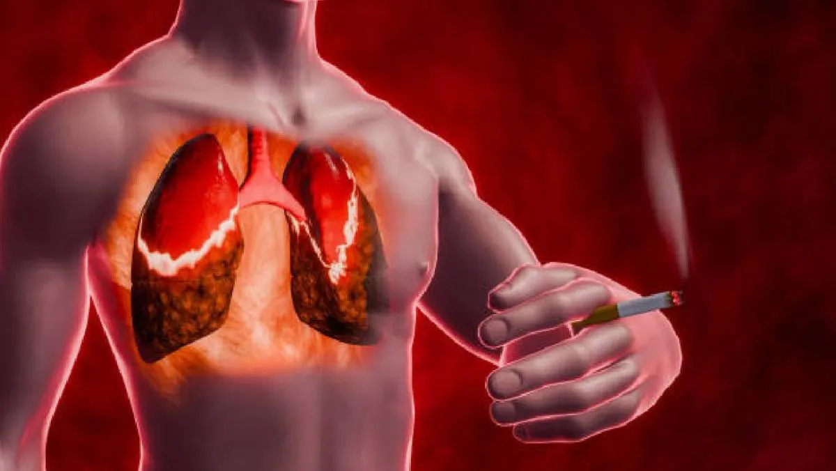 Para el subtipo SIRD, el riesgo fue aproximadamente el doble en quienes han fumado alguna vez. / Pixabay