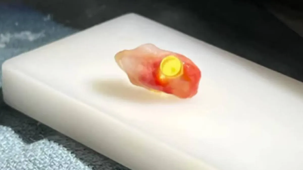 El procedimiento comenzó con la extracción de un diente, al que se le colocó un cilindro óptico. / RS