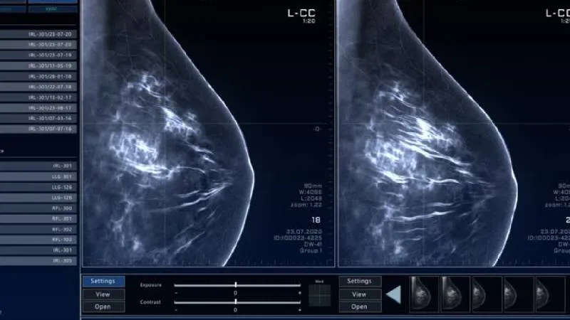 La Procuraduría recomienda a las consumidoras extremar precauciones antes de aceptar cualquier promoción. / Pixabay