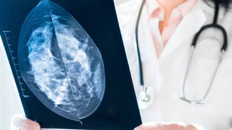 El cáncer de mama es uno de los tipos de cáncer más comunes en mujeres. / Pixabay