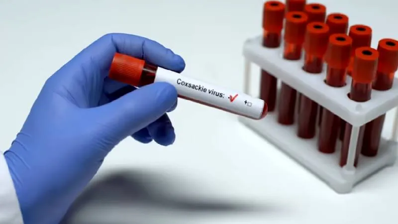 El virus Coxsackie afecta principalmente a niños menores de 10 años y se transmite por contacto directo./ Pixabay