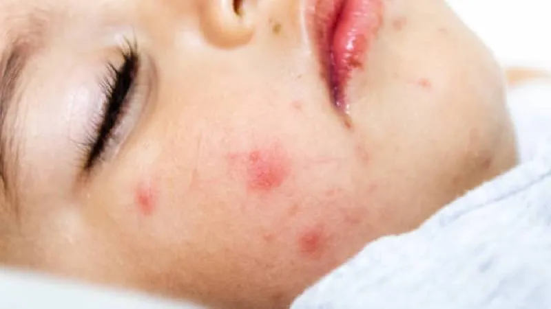 Escuelas y espacios públicos implementaron medidas de desinfección y reforzamiento sanitario para prevenir nuevos contagios./ Pixabay