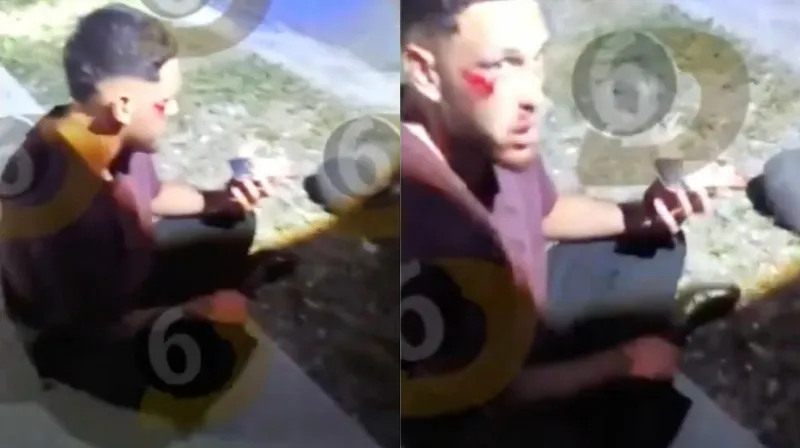 Lucas Ocampos tras el accidente | Multimedios