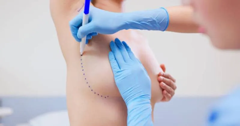 Las sanciones contemplan penas de prisión para quienes realicen intervenciones cosméticas en menores sin causa médica. / iStock