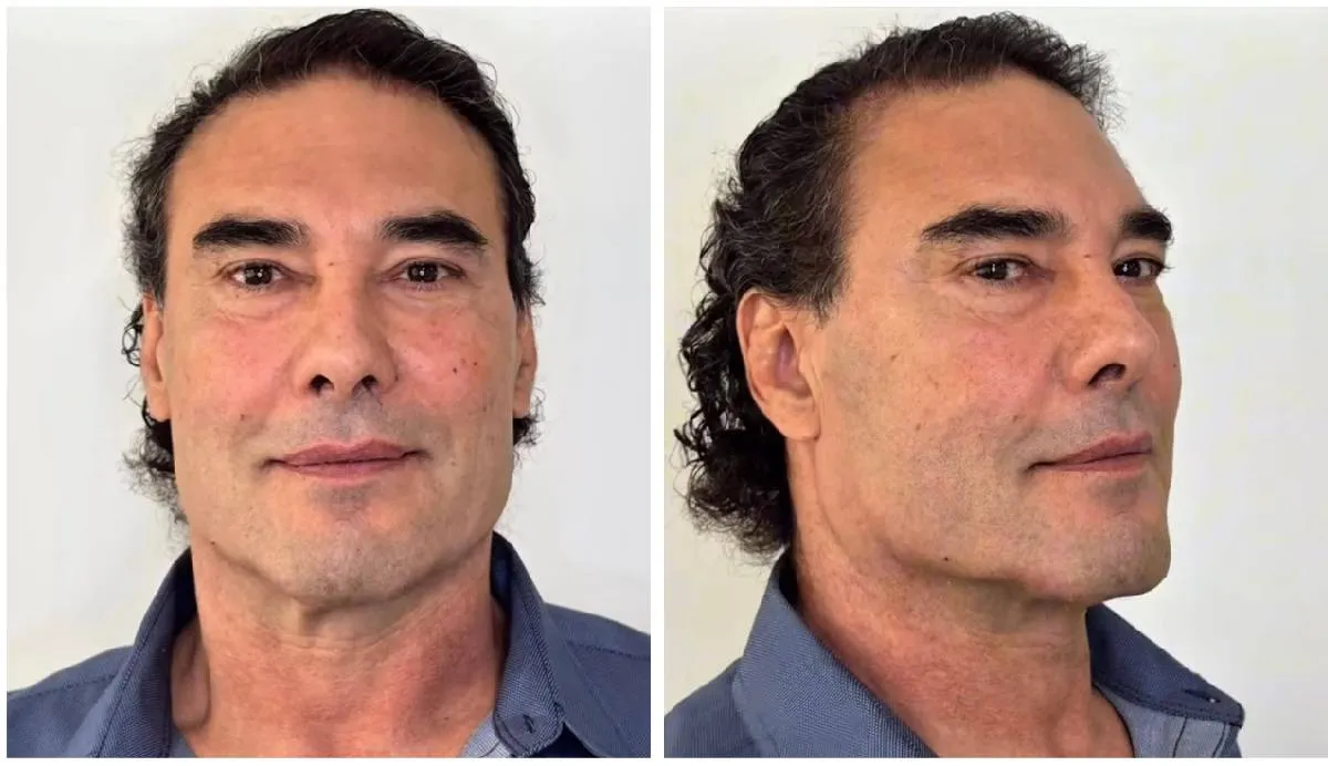 El actor mostró su nuevo aspecto visiblemente más juvenil, firme y definido | Redes sociales