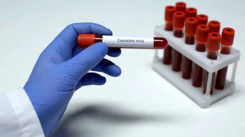 En octubre de 2025, se han reportado brotes significativos en varios estados mexicanos