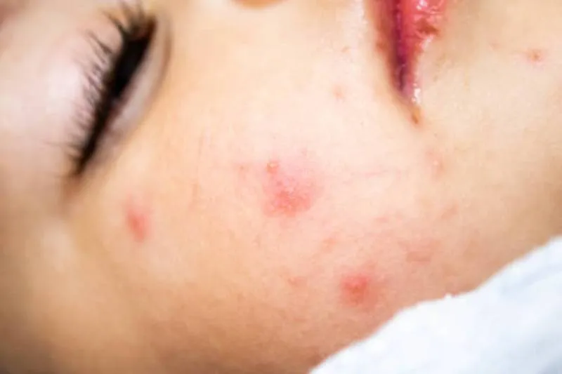 Seguir las recomendaciones de la Secretaría de Salud ayuda a evitar contagios y proteger a los niños | iStock