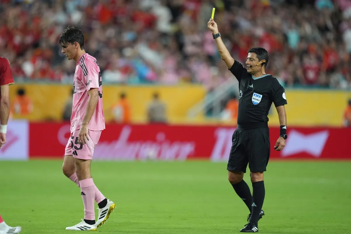 Tarjeta amarilla | AP