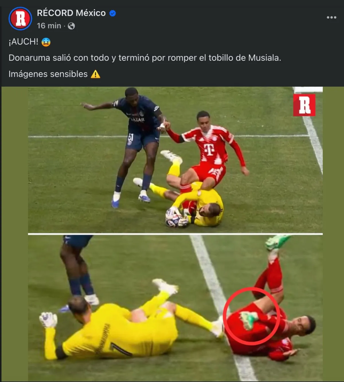 La lesión | Captura de pantalla