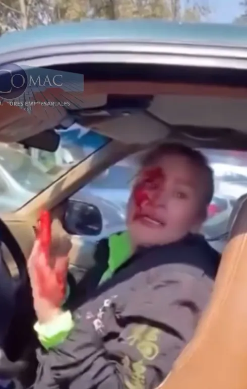 La señora Edith no sabía que había pasado para que la golpearan / Redes Sociales