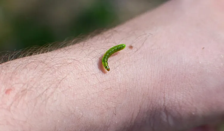 El gusano se generó porque el hombre no se atendió una mordida / FREEPIK