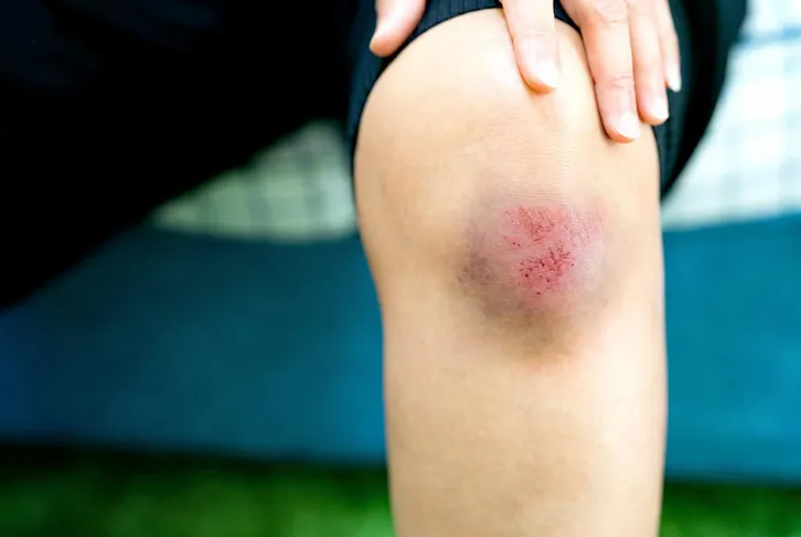 El paciente fue mordido por un perro, pero no se atendió la herida / FREEPIK