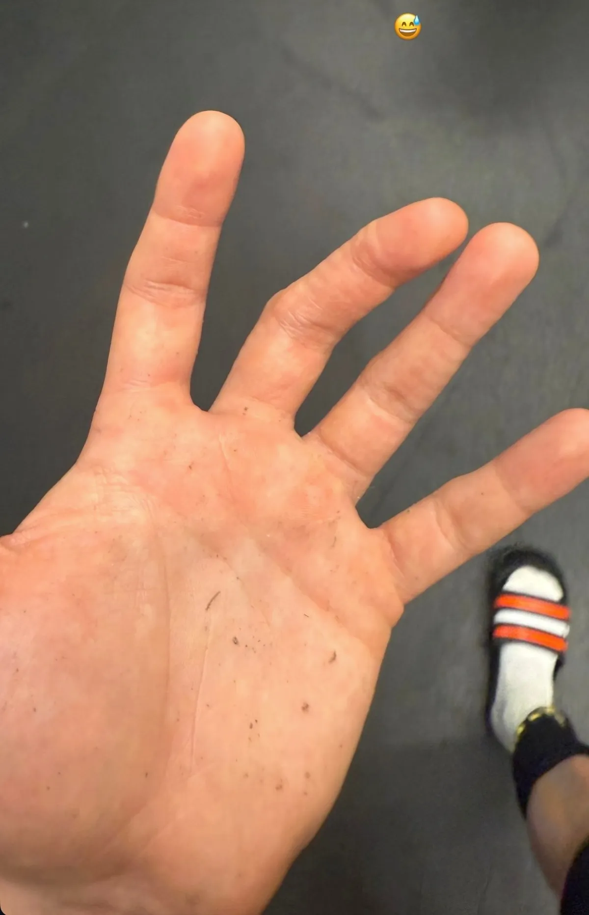 La lesión | @sant.gimenez