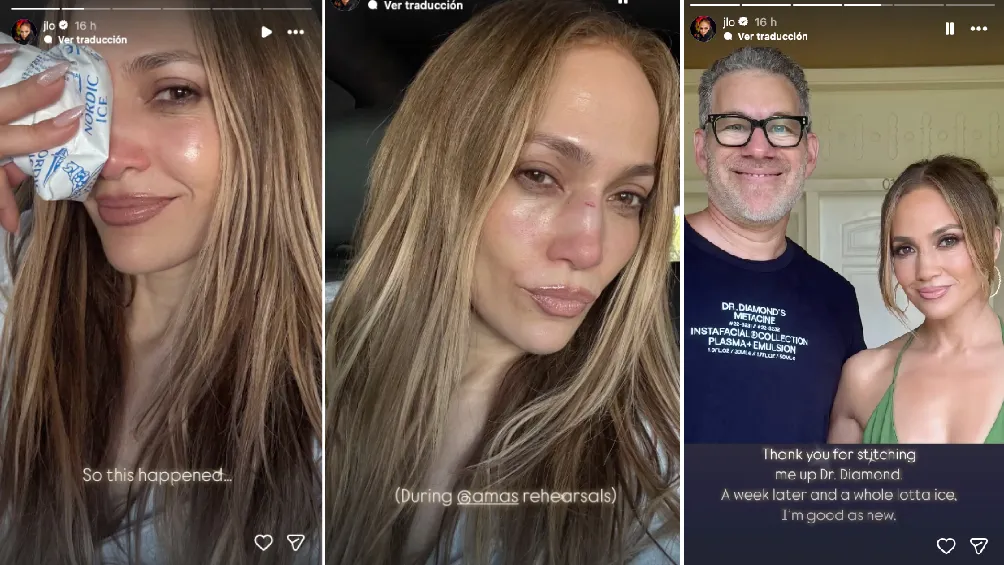 JLo apareció en la herida en la cara y con el cirujano que la atendió / FB: @jenniferlopez
