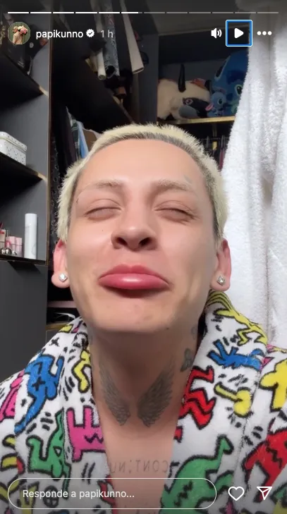 Kunno explicó cómo lo golpearon entre tres o cuatro personas / Redes Sociales