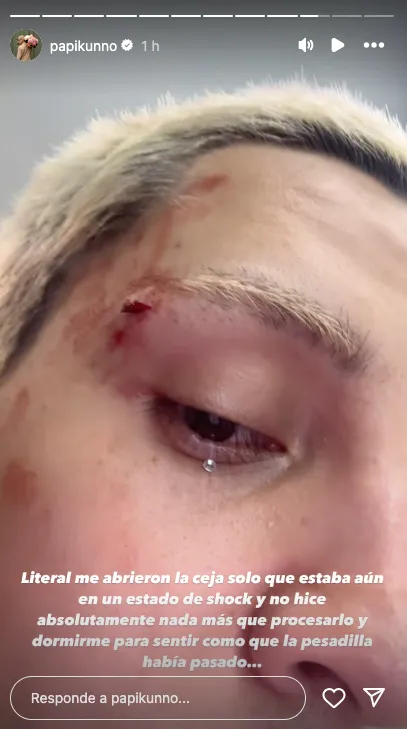 De un puñetazo le abrieron la ceja, luego de insultarlo / Redes Sociales