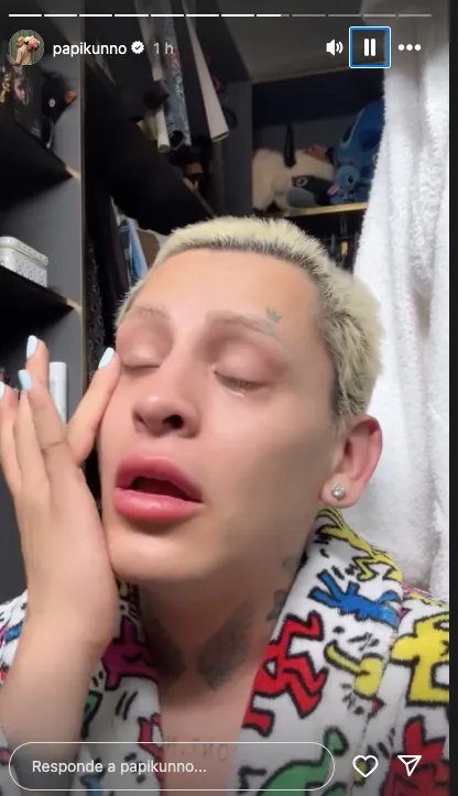 Kunno lamenta que este tiempo sigan los ataques homofóbicos / Redes Sociales