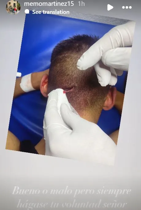 Herida que sufrió Guillermo Martínez