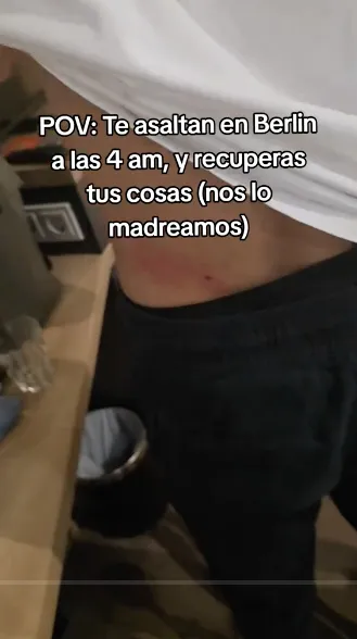 Uno de los mexicanos resultó con raspones en la espalda y rodilla / Redes Sociales