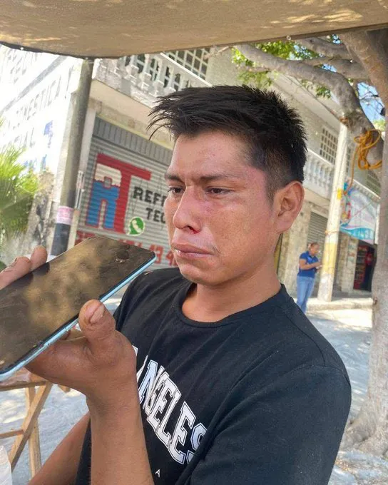 Miguel confía en que las autoridades detengan a sus agresores / Rede Sociales