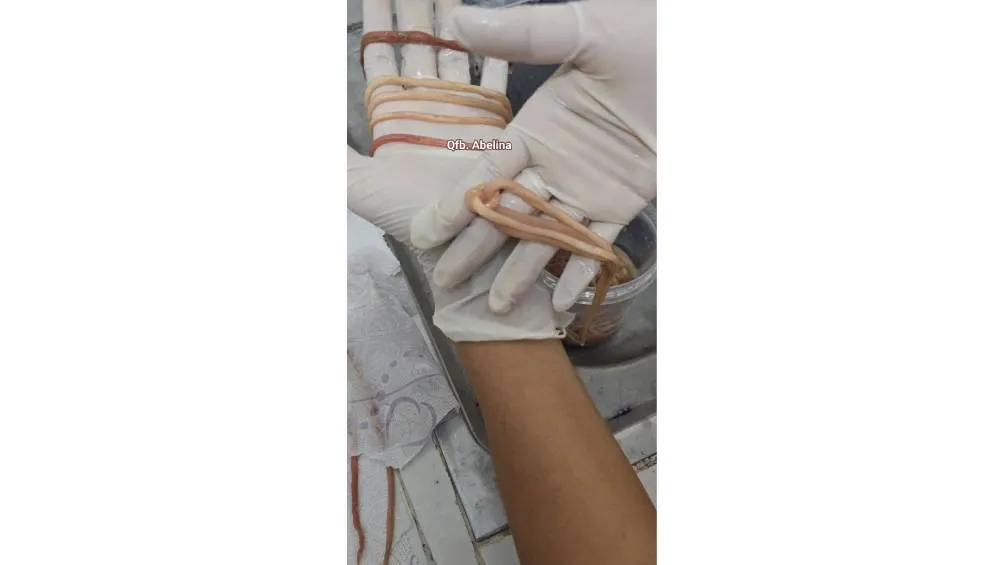 El menor, tras la cirugía y el tratamiento antiparasitario correspondiente. / FB