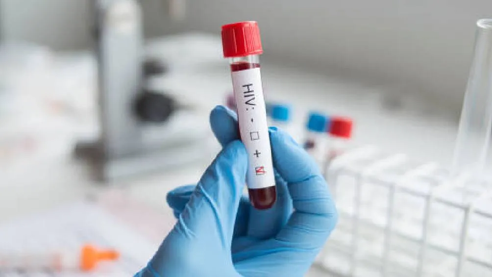 Casi toda América Latina no ha conseguido un acuerdo que permita el acceso a medicamentos genéricos eficaces para prevenir infecciones por VIH. | Pixabay