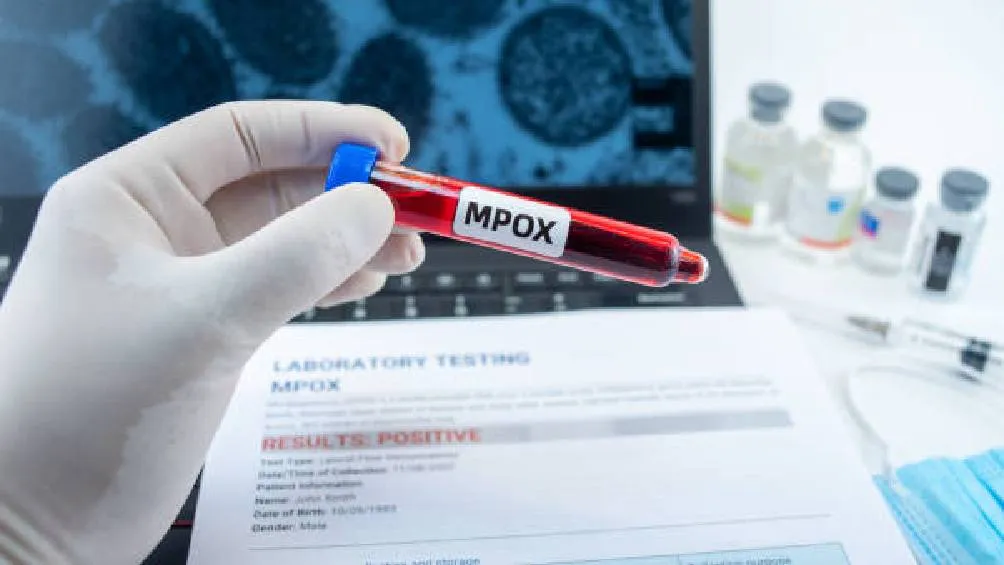 El Centro para el Control y la Prevención de Enfermedades de China ha confirmado un brote de una nueva variante de Mpox (viruela símica). | Pixabay