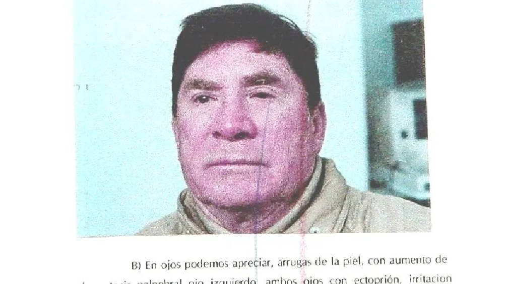 Fonseca Carrillo enfrentó problemas de salud, como cáncer de colon y pérdida de visión. / RS