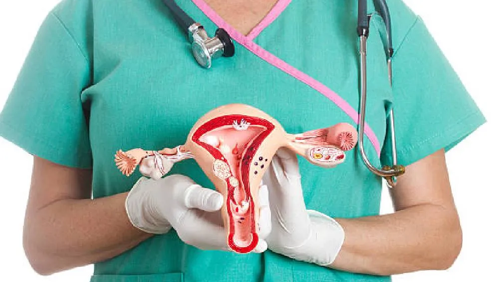 El cáncer cervicouterino es un tipo de cáncer que se desarrolla en el cuello del útero, la parte inferior del útero. / Pixabay