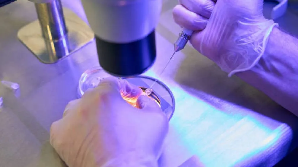 STAR está enfocada en encontrar y recuperar espermatozoides vivos en hombres con azoospermia | iStock