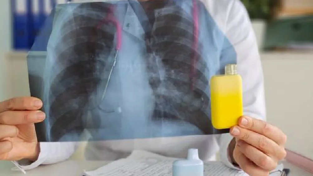 El tratamiento fue probado en cuatro grupos de ratas expuestas al vapor de cigarrillos electrónicos durante un mes. / Pixabay