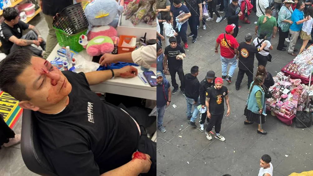 Una hombre de 58 años sufrió un golpe en el rostro/X