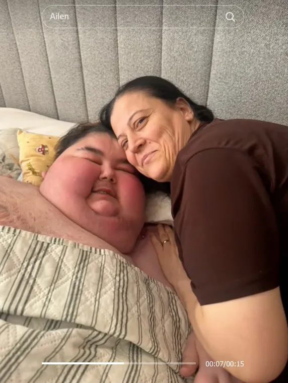 El joven turco empezó a desarrollar enfermedades por su sobrepeso / Redes Sociales