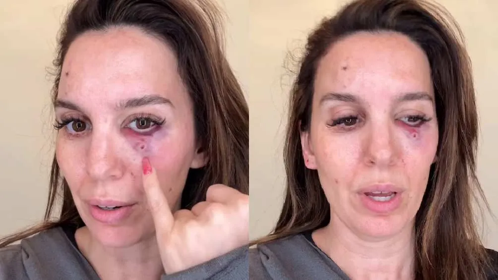 Christy agradeció a la vida por recibir una segunda oportunidad/IG: @thechristycarlsonromano