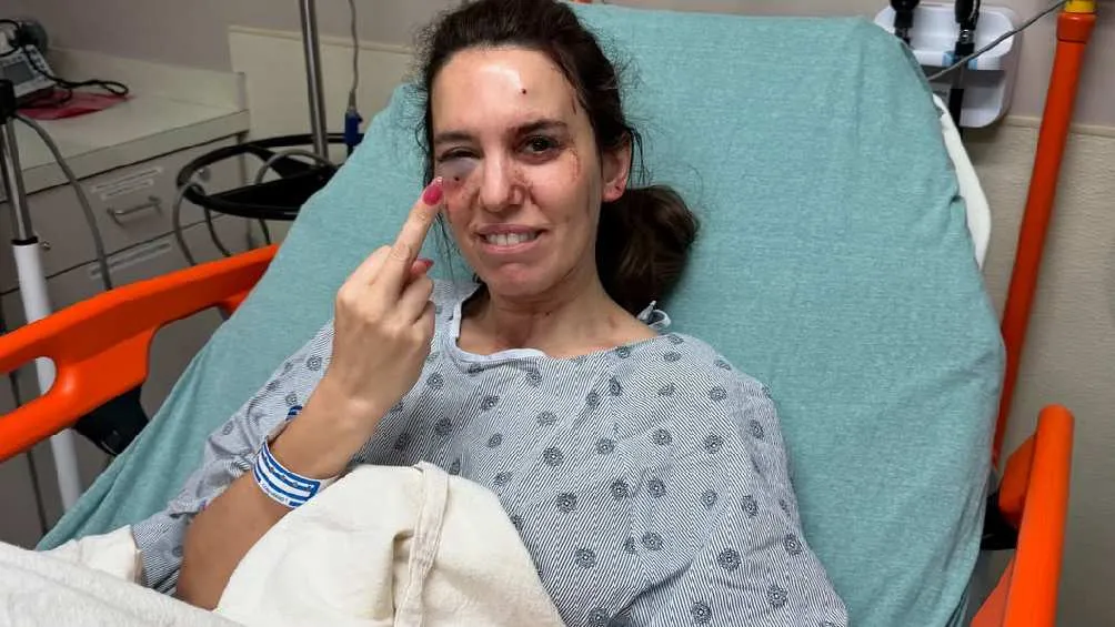 La actriz de Disney Channel presenta un objeto detrás del ojo, pero no perdió la vista/IG: @thechristycarlsonromano