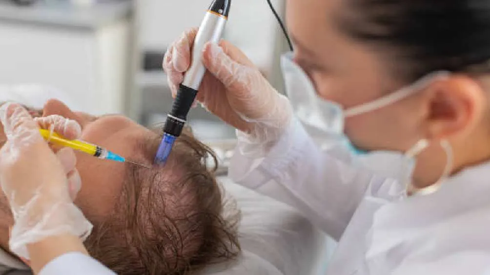 No es la cura para la calvicie, pero este descubrimiento sí es más afectivo que otros tratamientos/Pixabay