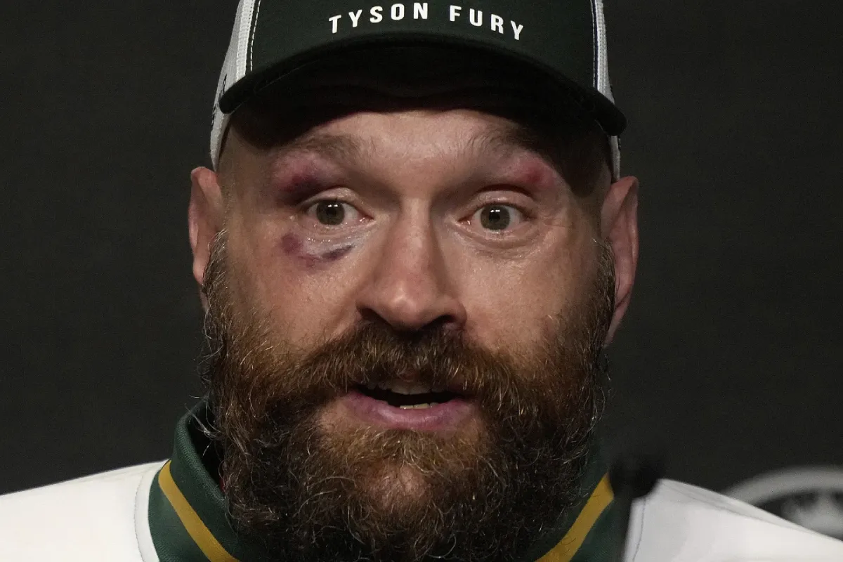 Tyson Fury | AP