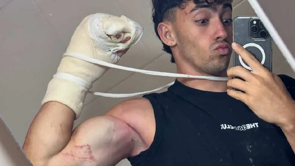 Algunos de sus seguidores pusieron en duda que haya sufrido un accidente/IG: @geroarias