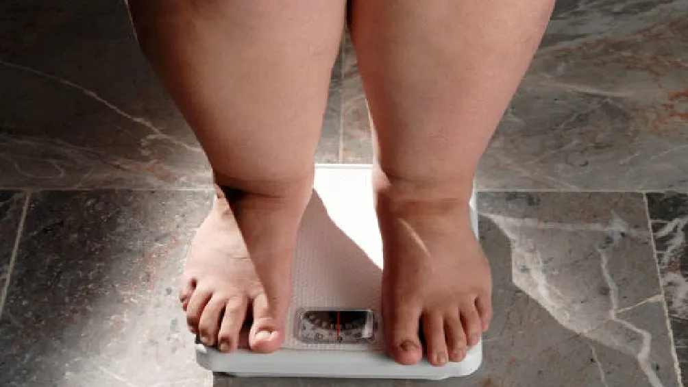 El evento reunió a especialistas nacionales e internacionales que coincidieron en que la obesidad es un problema complejo/iStock