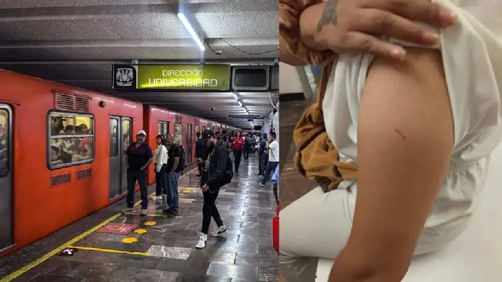 Ya va más de 10 casos de pinchazos en el Metro de CDMX/X