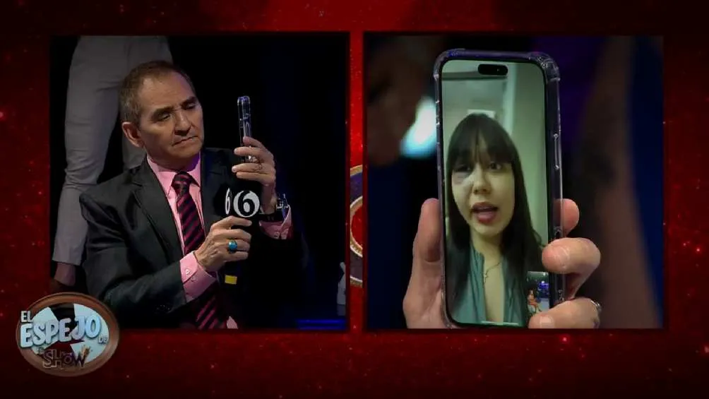 La modelo presenta un fuerte golpe en un pómulo/Multimedios