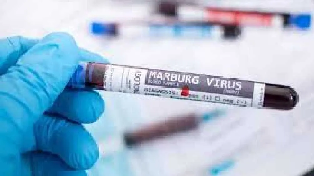 No hay cura ni tratamiento para el virus Marburgo/Pixabay